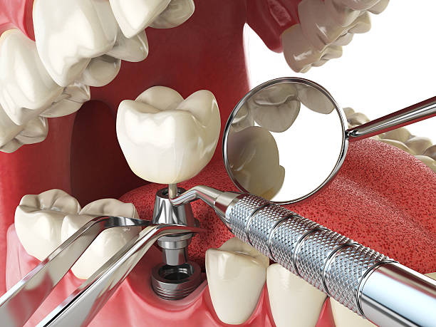 Best Emergency Cosmetic Dentistry (e.g., broken veneers) in Plant City, FL